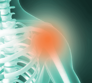 shoulder-pain – BennuLife Stem Cell Therapy